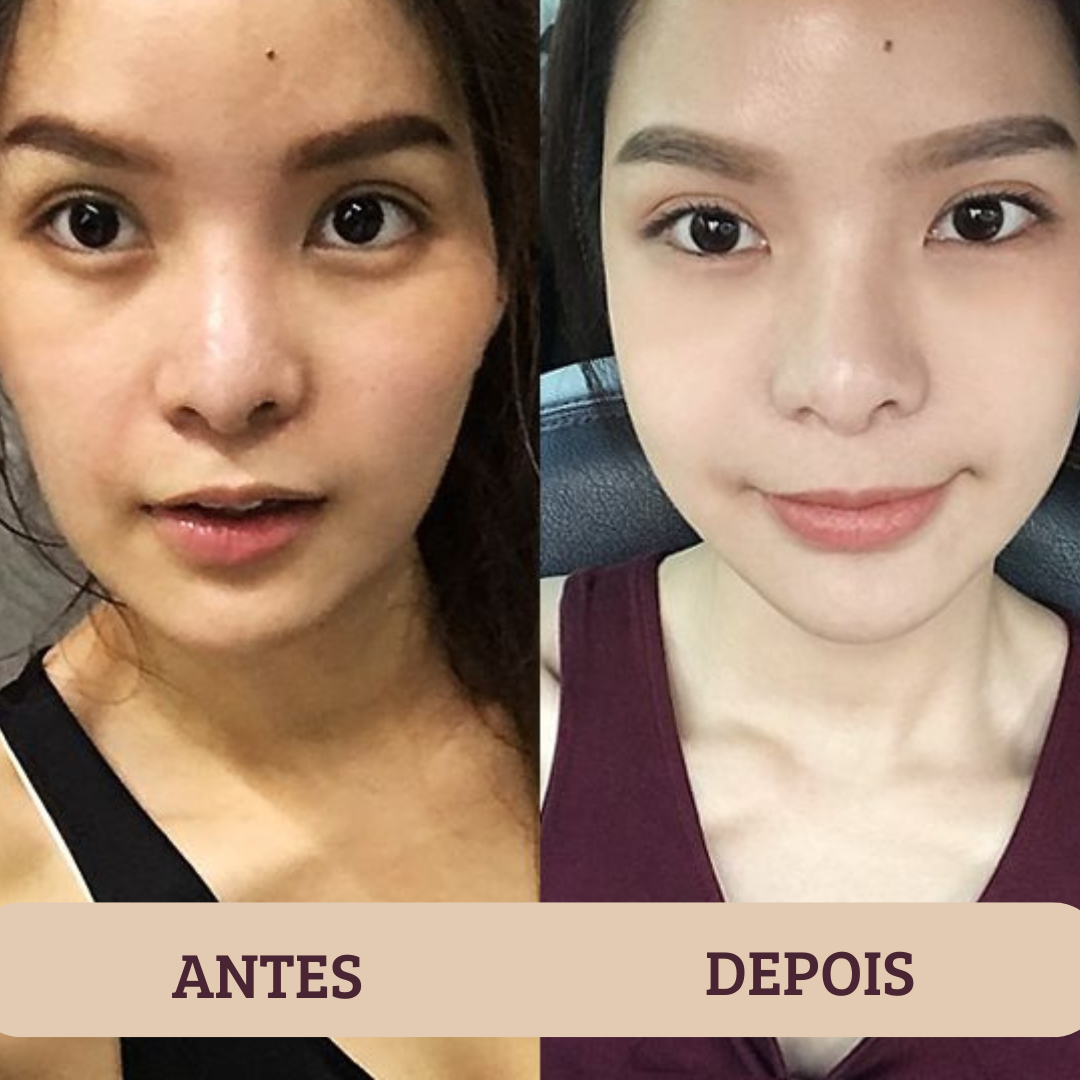 Antes e depois - Carla